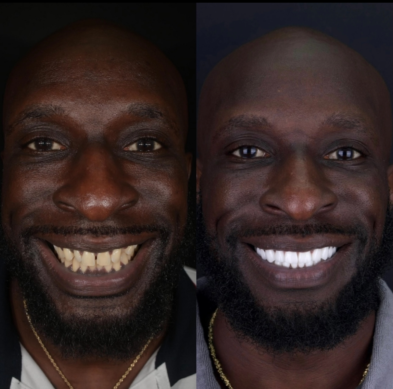 smiles2